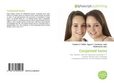 Capa do livro de Conjoined twins 