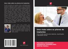 Uma visão sobre os pilares de implantes的封面