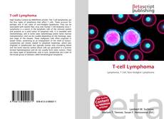 Bookcover of T-cell Lymphoma