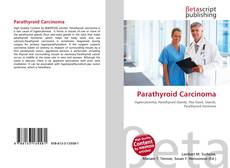 Bookcover of Parathyroid Carcinoma