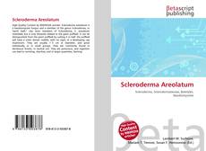 Bookcover of Scleroderma Areolatum