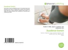 Bookcover of Duodenal Switch
