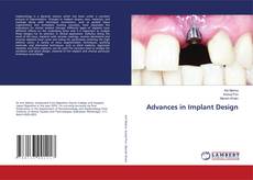 Copertina di Advances in Implant Design