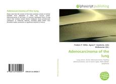 Borítókép a  Adenocarcinoma of the lung - hoz