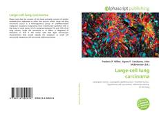 Large-cell lung carcinoma的封面
