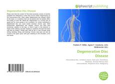 Degenerative Disc Disease的封面