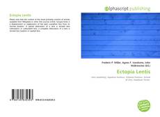 Bookcover of Ectopia Lentis