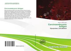 Buchcover von Carcinoembryonic Antigen