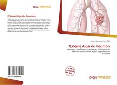 Bookcover of Œdème Aigu du Poumon