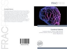 Portada del libro de Cerebral Edema