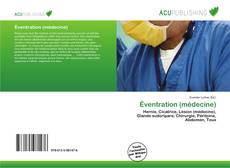 Bookcover of Éventration (médecine)