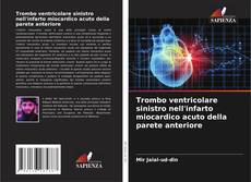 Trombo ventricolare sinistro nell'infarto miocardico acuto della parete anteriore kitap kapağı