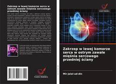 Copertina di Zakrzep w lewej komorze serca w ostrym zawale mięśnia sercowego przedniej ściany