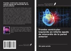 Capa do livro de Trombo ventricular izquierdo en infarto agudo de miocardio de la pared anterior 