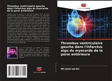 Bookcover of Thrombus ventriculaire gauche dans l'infarctus aigu du myocarde de la paroi antérieure