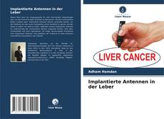 Обложка Implantierte Antennen in der Leber