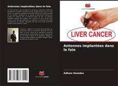 Buchcover von Antennes implantées dans le foie