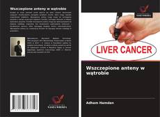 Copertina di Wszczepione anteny w wątrobie