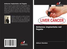 Borítókép a  Antenna impiantata nel fegato - hoz