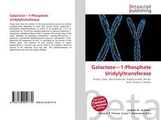 Buchcover von Galactose—1-Phosphate Uridylyltransferase