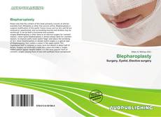 Buchcover von Blepharoplasty