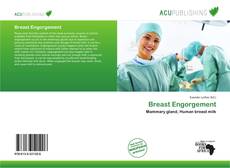 Copertina di Breast Engorgement
