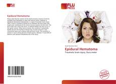 Bookcover of Epidural Hematoma