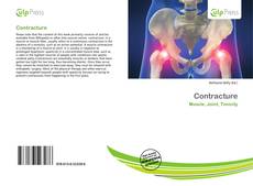 Bookcover of Contracture