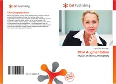 Buchcover von Chin Augmentation