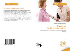 Bookcover of Carotid Endarterectomy