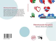 Copertina di Fibromuscular Dysplasia
