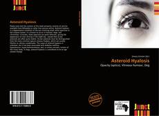Asteroid Hyalosis kitap kapağı