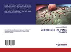 Bookcover of Carcinogenesis and Protein Kinase C
