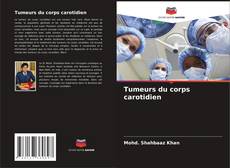 Tumeurs du corps carotidien的封面