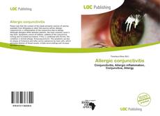 Couverture de Allergic conjunctivitis