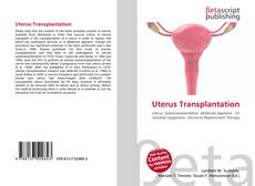 Buchcover von Uterus Transplantation