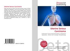 Copertina di Uterine Serous Carcinoma