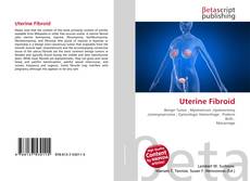 Copertina di Uterine Fibroid