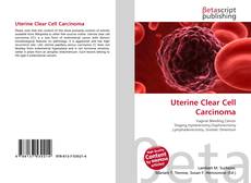 Copertina di Uterine Clear Cell Carcinoma