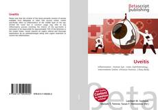 Capa do livro de Uveitis 