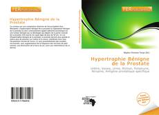 Buchcover von Hypertrophie Bénigne de la Prostate