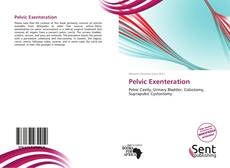 Обложка Pelvic Exenteration