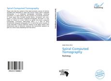 Portada del libro de Spiral Computed Tomography