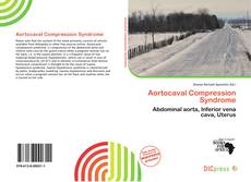 Copertina di Aortocaval Compression Syndrome