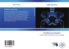 Capa do livro de Prothèse de Hanche 