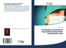 Antibiotikus prophylaxis nagyízületi endoprotézis beültetések során的封面