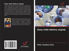 Guzy ciała tętnicy szyjnej的封面