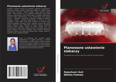Bookcover of Planowane ustawienie siekaczy