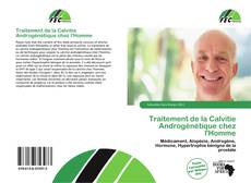 Traitement de la Calvitie Androgénétique chez l'Homme kitap kapağı