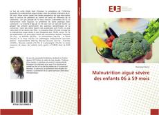 Обложка Malnutrition aiguë sévère des enfants 06 à 59 mois